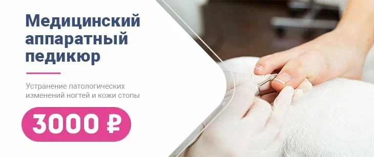 Медицинский аппаратный педикюр = 3000 рублей